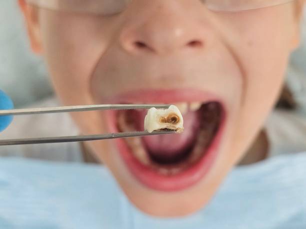 Best Urgent Tooth Repair  in Voorheesville, NY